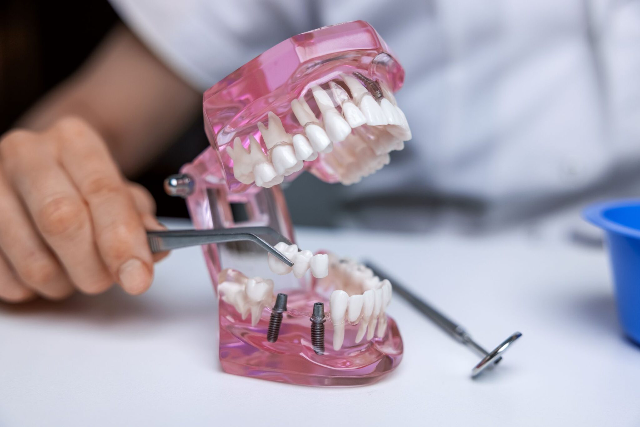 Dental implant model demonstration showing artificial teeth placement using precision tools on a pink jaw replica.
