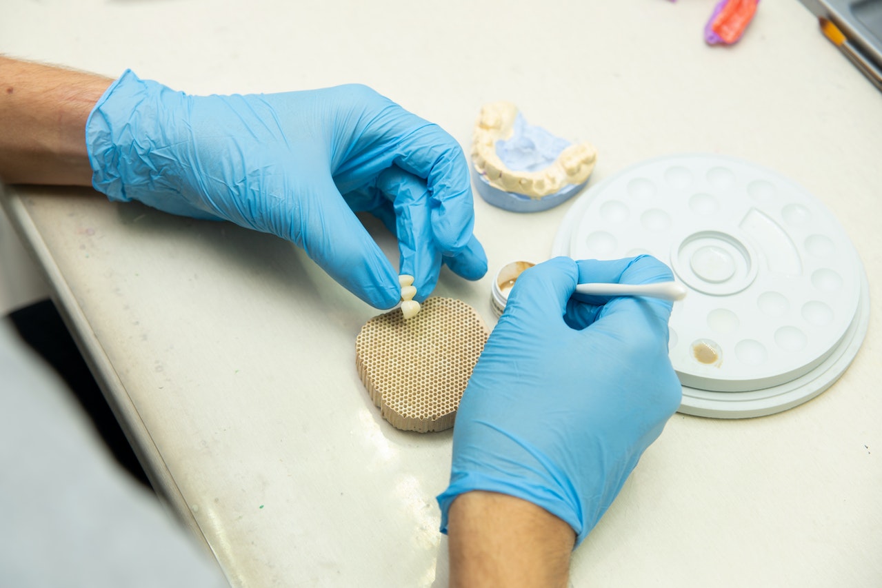 Dental technician in blue gloves shaping and coloring a ceramic tooth crown using tools and a model.