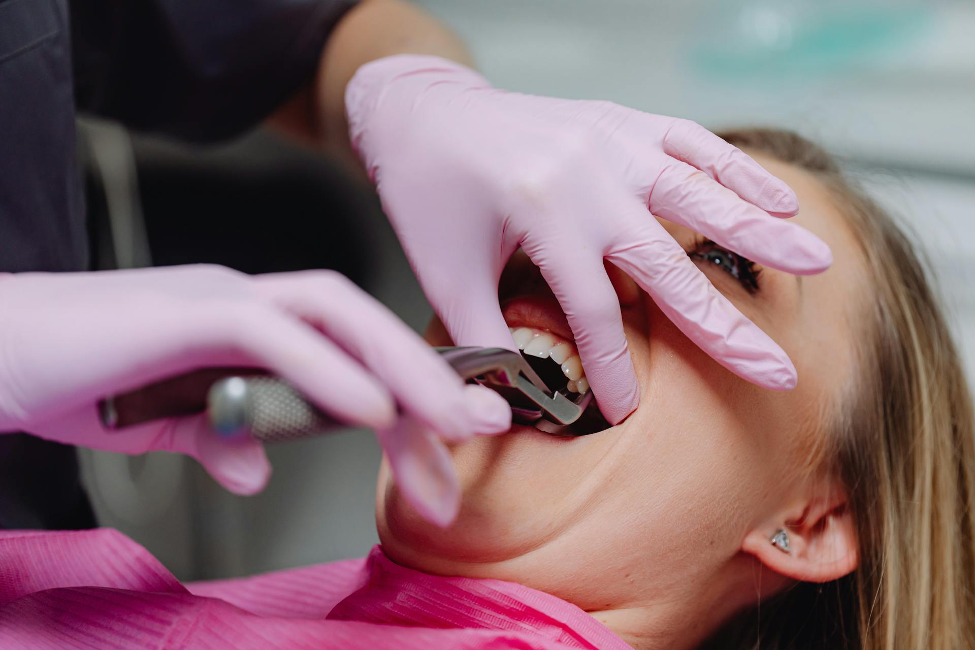 Dentist performing a tooth extraction with forceps while the patient lies back during the procedure.