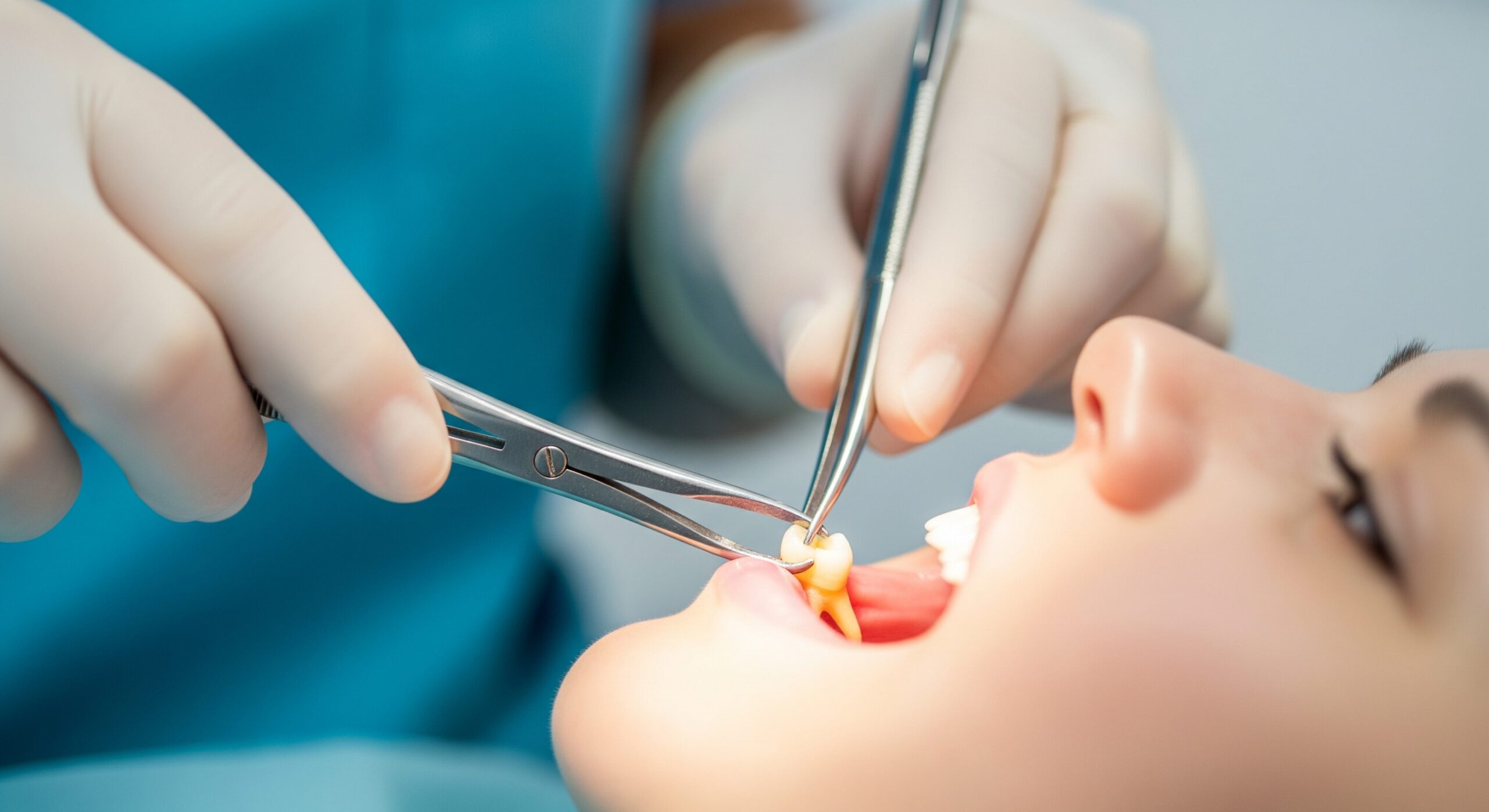 Close-up of a dentist performing a tooth extraction using forceps and dental instruments.