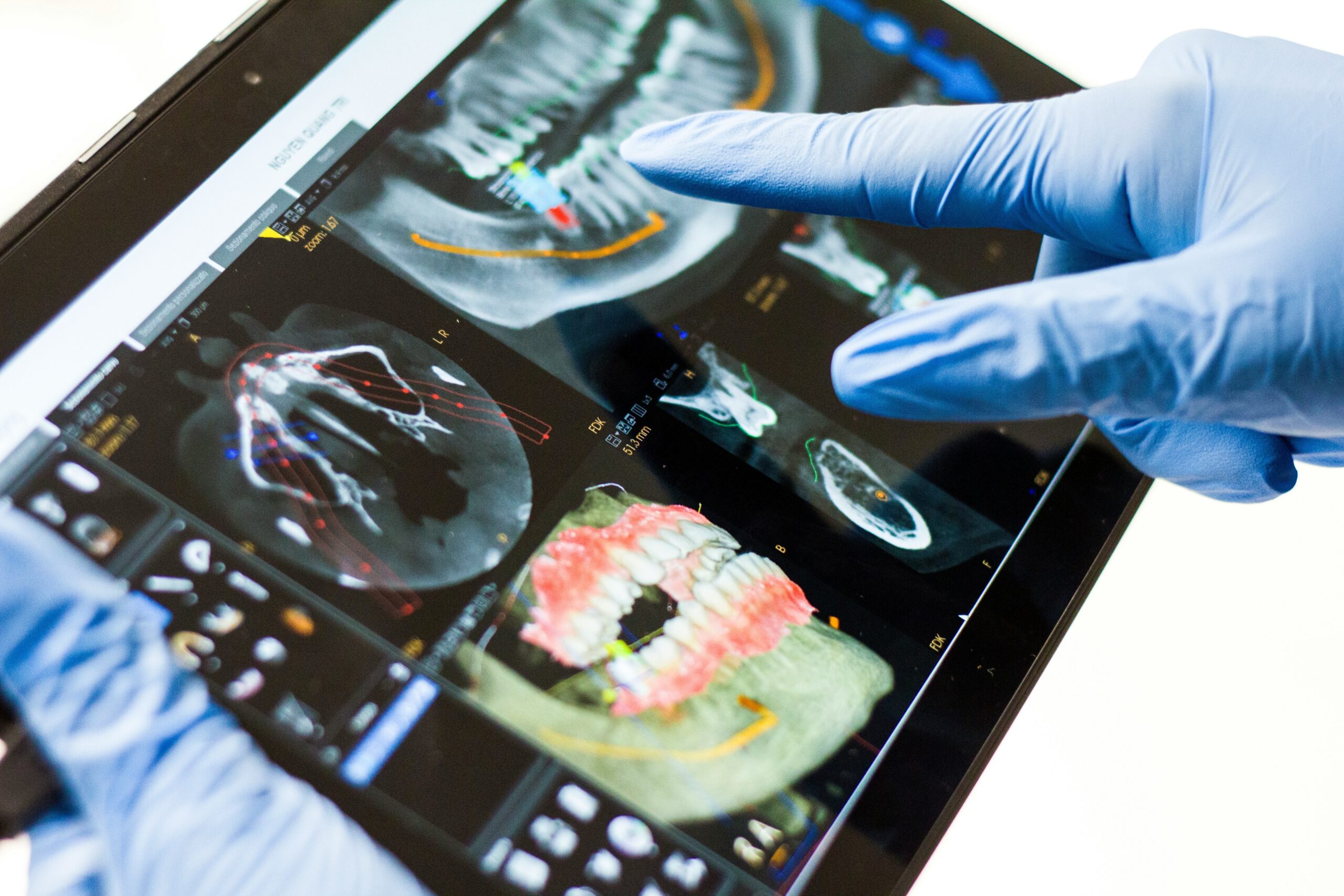 Gloved dental professional reviewing detailed 3D dental scans and X-rays on a digital tablet for diagnosis.